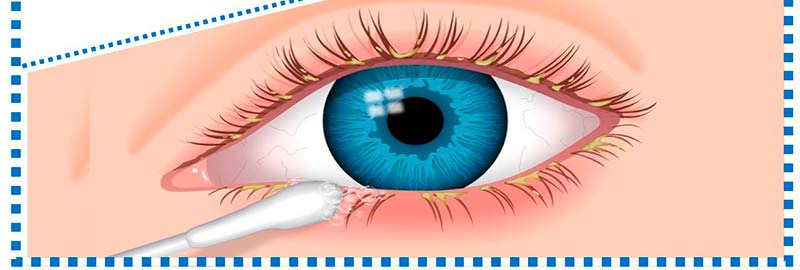 Cuidado de los párpados